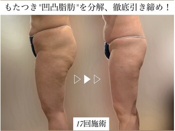 サロンハート(Salon Heart)/