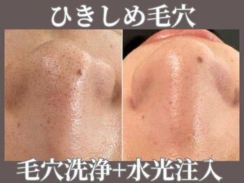 マヴィ 守口店(MavY.)/汚れスッキリ&保湿引き締め