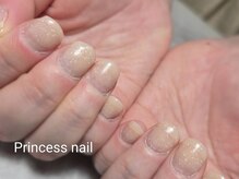 プリンセスネイル(Princess nail)/深爪矯正ベーシック