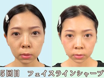 ナチュラルパーフェクトフェイス 新宿/整うとお化粧も楽に/新宿駅小顔