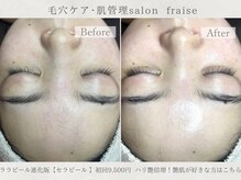 フレーズ(fraise)の雰囲気(セラピールで韓国女優のようなツヤ肌をゲット)