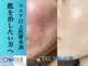 んまちの写真