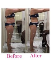 えすてさろん ケイアンドエフ(k&f)/施術結果11回/30代お客様