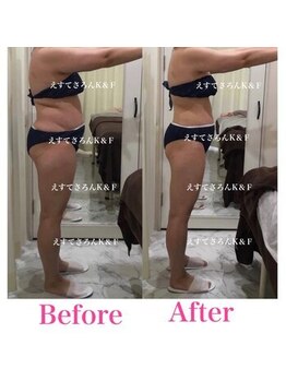 えすてさろん ケイアンドエフ(k&f)/施術結果11回/30代お客様