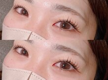 ルークスネイル(LOCUS NAIL)/