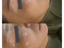 ルミエール シーサイド(L’MIERE seaside)/潤い補給で目元の小じわ改善