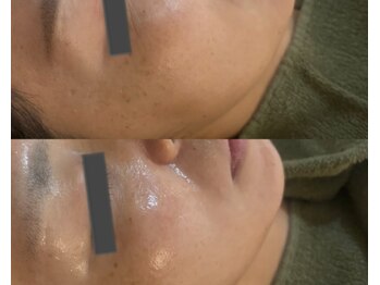 ルミエール シーサイド(L’MIERE seaside)/潤い補給で目元の小じわ改善