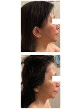 ミューズ よもぎ蒸し(MUSE)/◆インモード◆