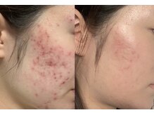 ビガク(BIGAKU)/がんこなお悩みに◎