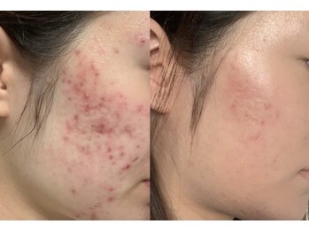 ビガク(BIGAKU)/がんこなお悩みに◎