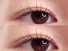 アリー(Ally)/デザイン豊富！！