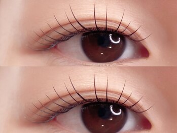 アリー(Ally)/デザイン豊富！！