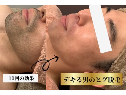 ラ ボーテ(La Beaute)の写真
