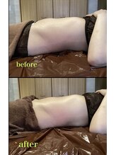 サロンドリマ(Salon de Lima)/お腹１回の施術効果！