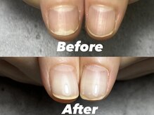 結(Yui)/自爪育成 Before→After