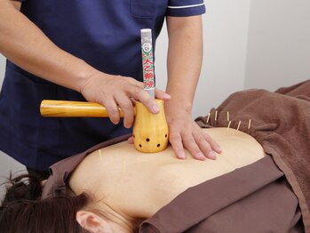 シャローム鍼灸院の写真/25年以上の経験を持つ鍼灸師が対応★肩こり・不眠・冷えなど、東洋医学の知恵で一人ひとりに寄り添う施術◎