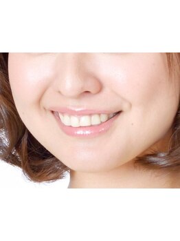 美白ケアをしたい