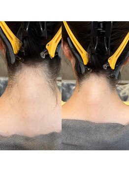 ベラノーブル(bella noble)/うなじシェービング