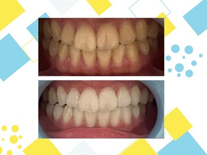 ポノケアサロン(PONO KEA SALON)の写真