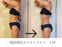 シーズ/ビフォーアフターその2