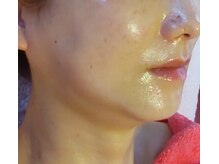 エステティック パルフェ/濃厚コラーゲン・グローマスク♪