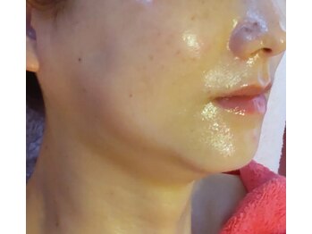 エステティック パルフェ/濃厚コラーゲン・グローマスク♪