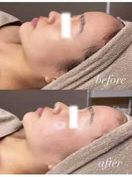 エユージュ(eyuge)/