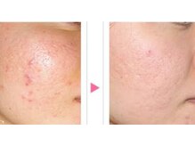 アロマビューティーサロン ジェイハウス(J)/