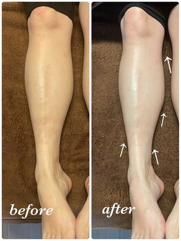 イーストモア(EAST MOIS)/気になる足のむくみスッキリ