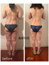 バンブー(bamboo)/ビフォーアフター