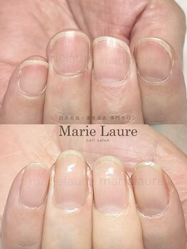 マリーロール 淀屋橋本店(Marie Laure)/自爪育成/深爪矯正/ネイルケア
