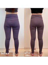 ベレミアム(Bellemium)/骨盤ケアで美脚作り