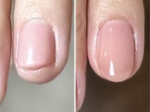 ツキヒ(Tsukihi)の雰囲気（自爪風ワンカラーネイル☆自爪育成・深爪の方にオススメ！）