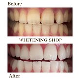 ホワイトニングショップ 三重松阪店