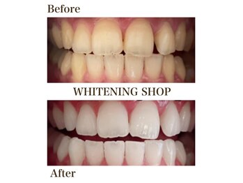 ホワイトニングショップ 三重松阪店