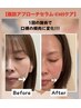 平日12-15時限定【New脂肪撃退☆小顔】脂肪アプローチセラム×キャビ×EMS