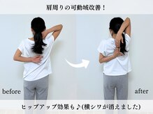 エーアール(AR)
