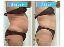 エムプラス(Mplus.)/痩身スリムカッター！！