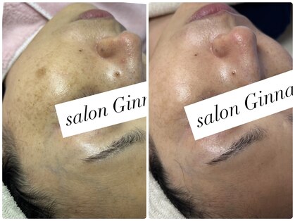 ジーナ(Ginna)の写真