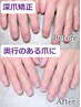 【ハンド】深爪矯正 長さ出し10本＋カラー★初回オイルプレゼント¥13000→
