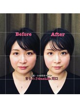 きらめき ワンライフ 川口(One Life)/小顔矯正BeforeAfter１５