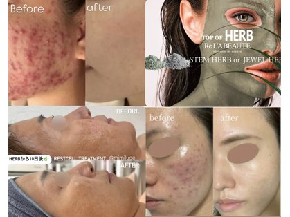 ミミルーチェ(mimiluce)の写真