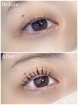 レピア 郡山駅前店/韓国式LEPIA Before&After