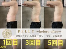 ペリー(PELLY)/男性20代　before after