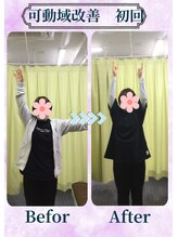 アミーゴ整体院/ビフォーアフター