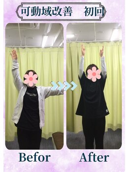 アミーゴ整体院/ビフォーアフター