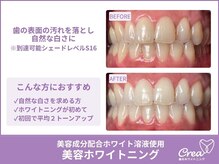 クレア(Crea)/【ホワイトニング症例写真】