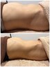 新メニュー【HOT腸もみ+骨盤調整】モニター様大募集！