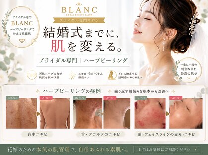 ブラン 名古屋高岳(BLANC)の写真