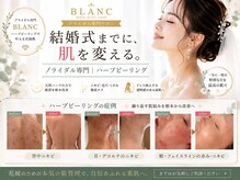 ブラン 名古屋高岳(BLANC)